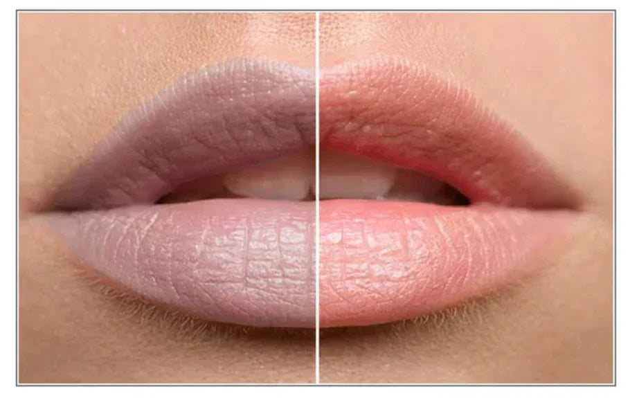 Lip Care 101: What should I do for dark, hyperpigmented lips?