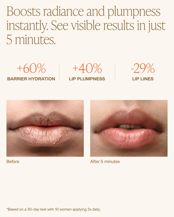 LIP DEW