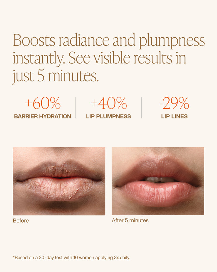 LIP DEW
